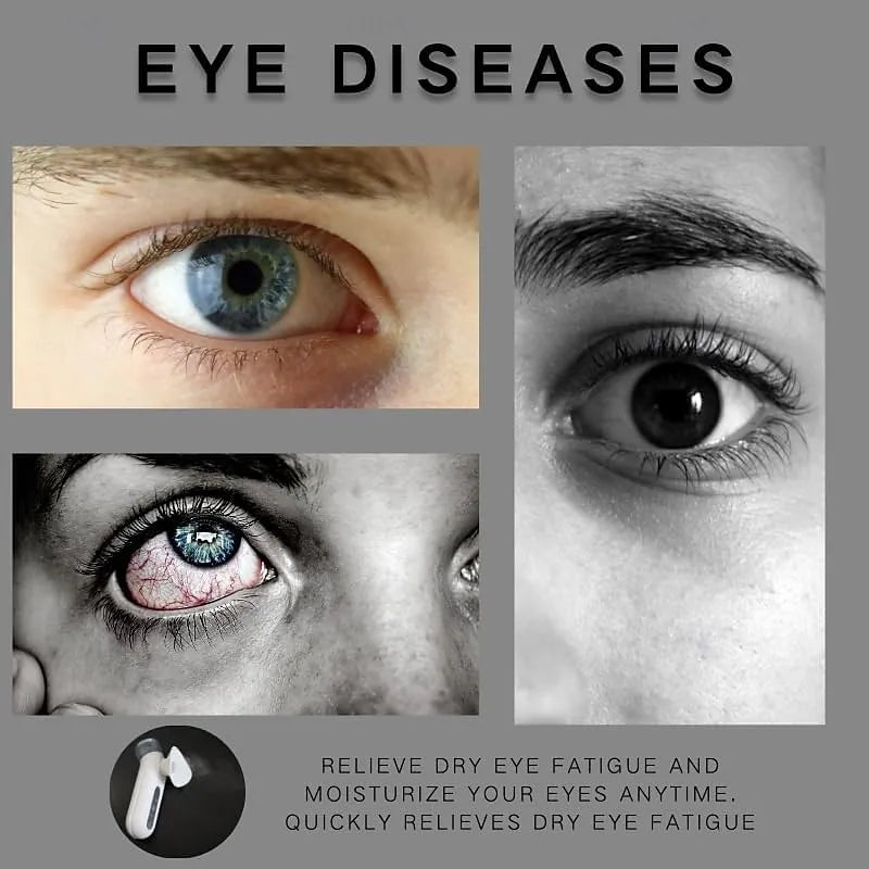 Electric Portable Eye Steamer | Eye Moistening Device
