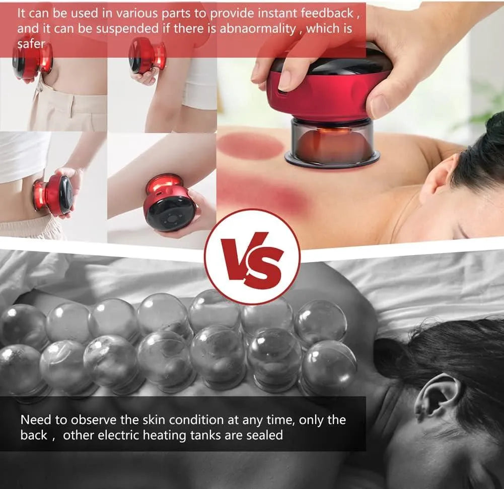 Smart Electric Cupping Massager