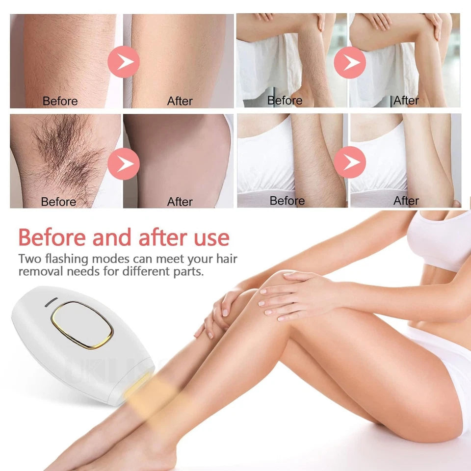 Mini IPL Hair Removel Device